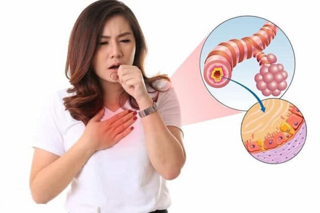 Bệnh viêm phế quản ở người lớn