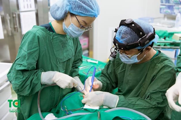 điều trị Viêm tai xương chũm có cholesteatoma