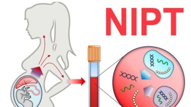Những điều cần biết trước khi làm xét nghiệm sàng lọc Nipt