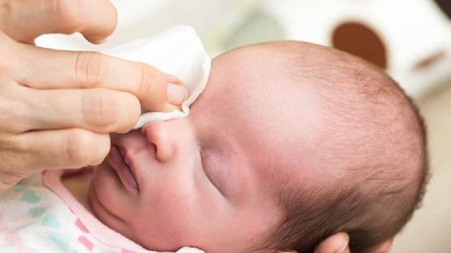 Hướng dẫn chăm sóc bé bị đau mắt đỏ