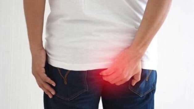 Bệnh trĩ gây ra muôn vàn phiền toái khó chịu