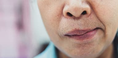 5 Cách nhận biết dấu hiệu đột quỵ bạn cần lưu ý