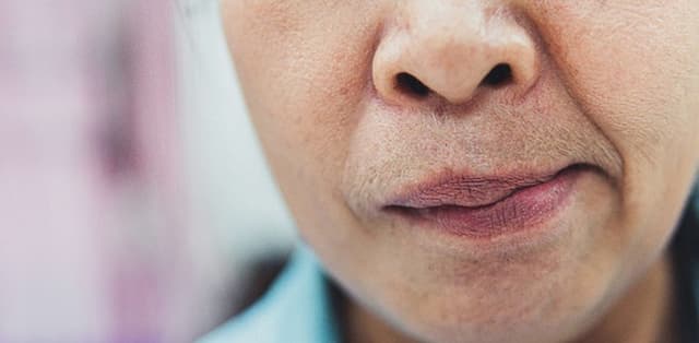 5 Cách nhận biết dấu hiệu đột quỵ bạn cần lưu ý