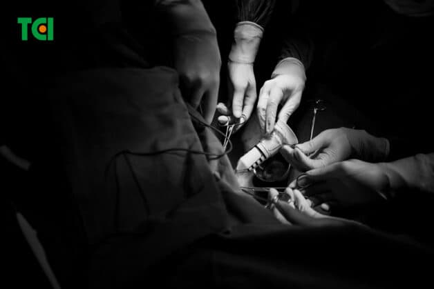 Điều trị trĩ bằng phương pháp Longo