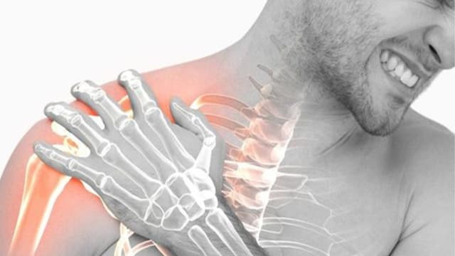 Gãy xương đòn bả vai có bắt buộc phải phẫu thuật không?