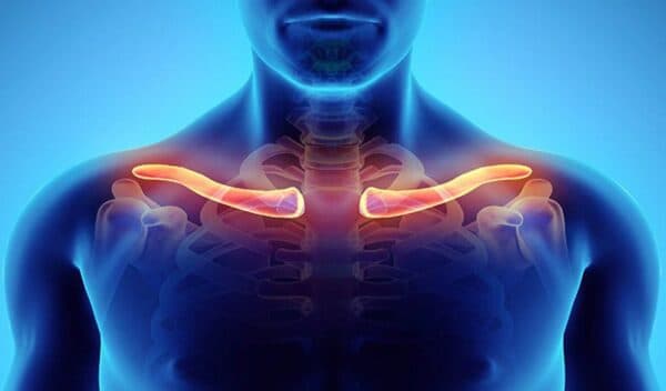 Triệu chứng gãy xương đòn vai