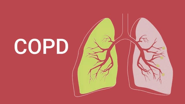 Bốn giai đoạn của bệnh phổi tắc nghẽn mạn tính COPD