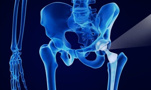 giải phẫu khớp háng