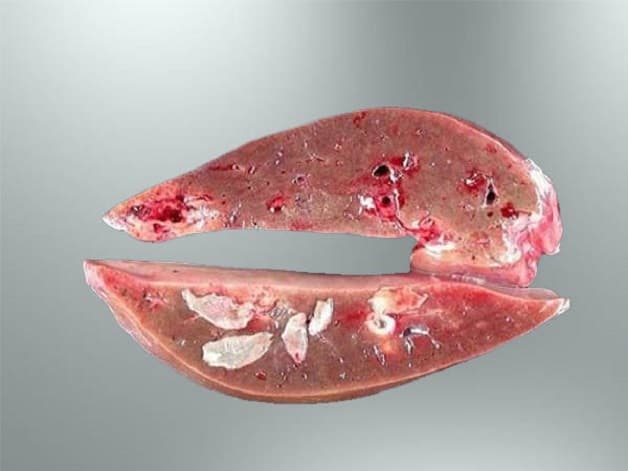 Sán lá gan kí sinh ở đâu và phát triển như thế nào?