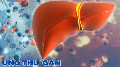 Kỹ thuật sinh thiết gan và những điều cần biết liên quan