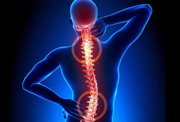 lao xương cột sống là bệnh gì?
