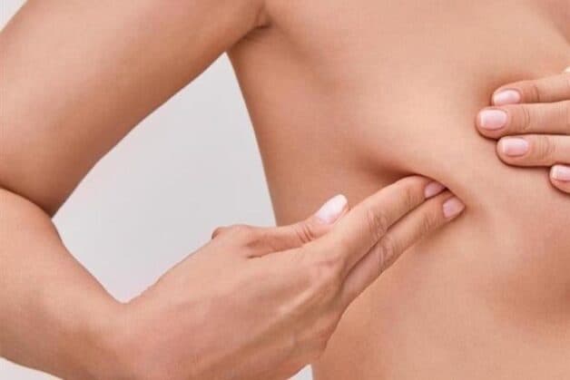 thay đổi mô vú là triệu chứng của bệnh ung thư phổi