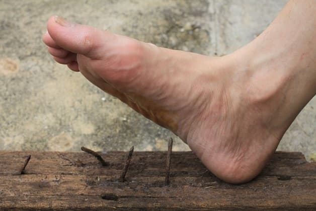 Vi khuẩn uốn ván Clostridium tetani thường tồn tại trong đất, trong phân và bụi bẩn hoặc bám trên bề mặt của đinh thép gỉ lâu ngày