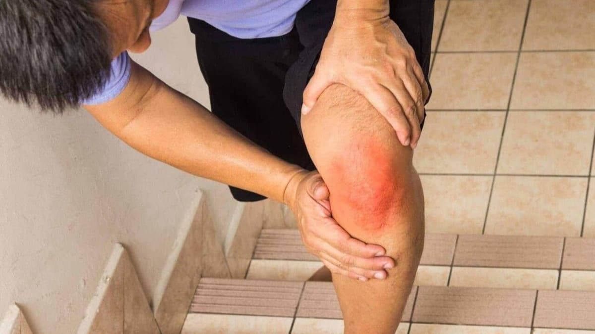 Rách sụn chêm gối là gì? Có nguy hiểm không?