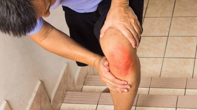 Rách sụn chêm gối là gì? Có nguy hiểm không?