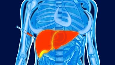 Quy trình sinh thiết gan dưới hướng dẫn siêu âm