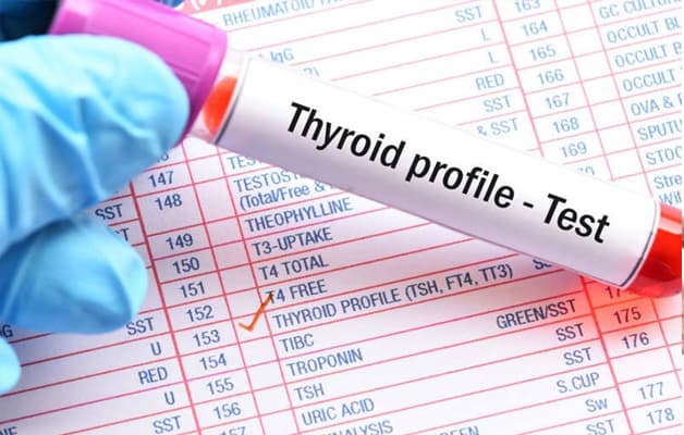 Xét nghiệm chức năng tuyến giáp.