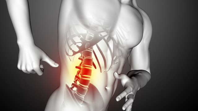 Tổng quan những điều cần biết về thoát vị đĩa đệm đốt sống lưng