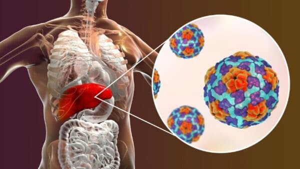 Viêm gan B lây từ mẹ sang con