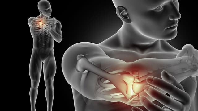 Viêm khớp dạng thấp: Điều trị sớm phòng nguy cơ biến chứng