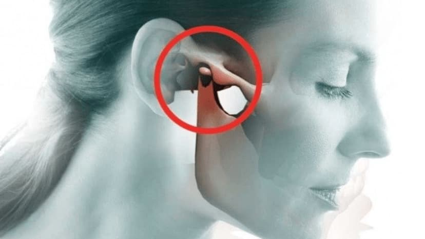 Viêm khớp thái dương hàm: Triệu chứng và nguyên nhân