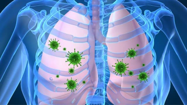 Viêm phổi ở người lớn: Nhận diện, nguyên nhân và cách phòng ngừa