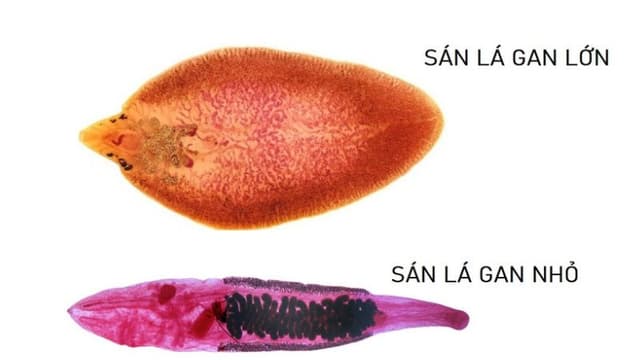 Tìm hiểu về ấu trùng sán lá gan