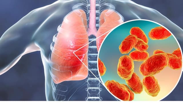 Quan hệ tình dục khi lao phổi và những lưu ý quan trọng cần biết