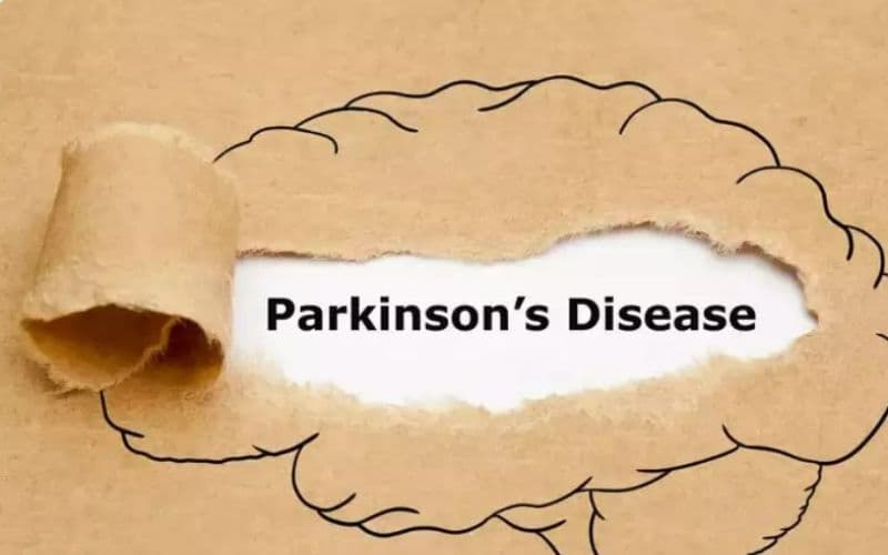 Bệnh Parkinson
