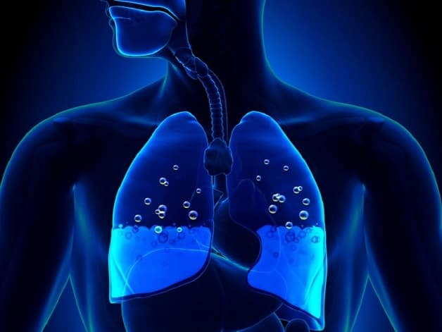 Hen phế quản trở nặng có nguy hiểm không 