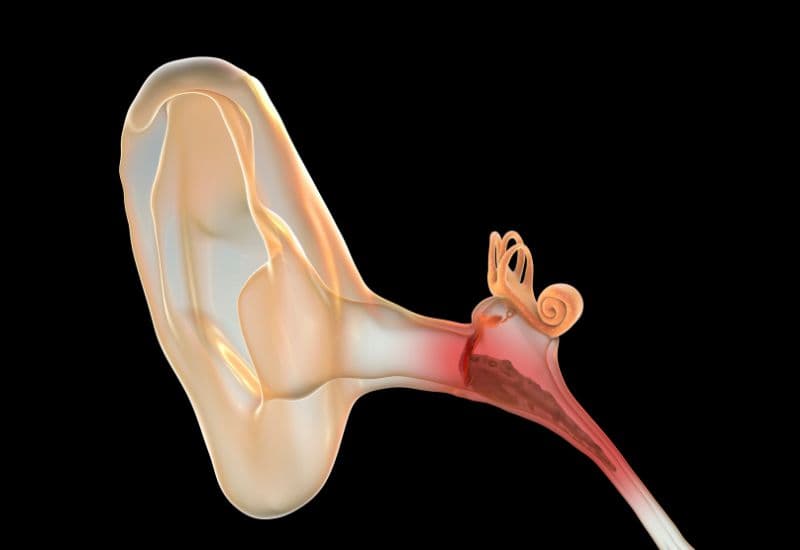 Viêm tai giữa ứ mủ là tình trạng tai giữa của trẻ bị tích tụ dịch.