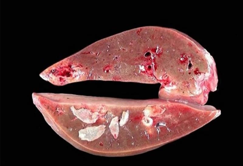 Đặc điểm dinh dưỡng sán lá gan