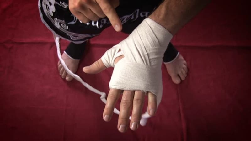 Đau cổ tay nguyên nhân do đâu?