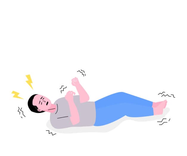 Biểu hiện của cơn co giật do bệnh động kinh