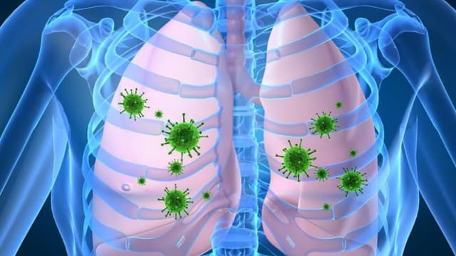 Vấn đề về di truyền lao: Những điều cần biết và cách phòng tránh