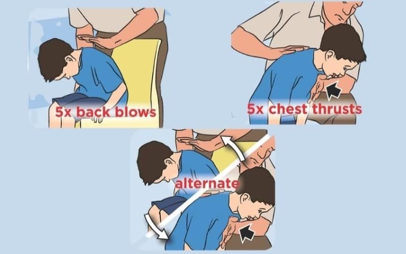 Xử lý trẻ bị mắc dị vật