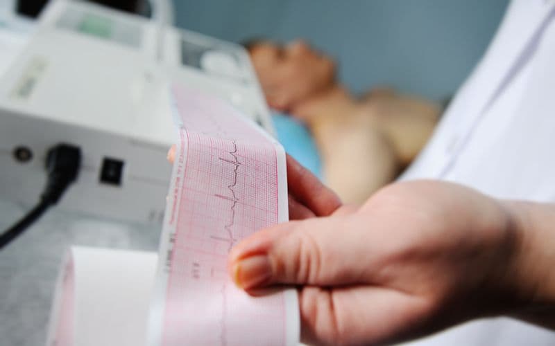 Đo điện tâm đồ là gì?