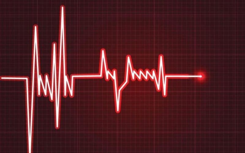 Cần lưu tâm một số vấn đề khi đo điện tâm đồ