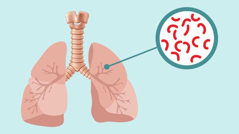 Quan hệ tình dục khi lao phổi có lây không?