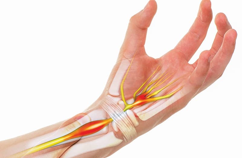 ống cổ tay là gì