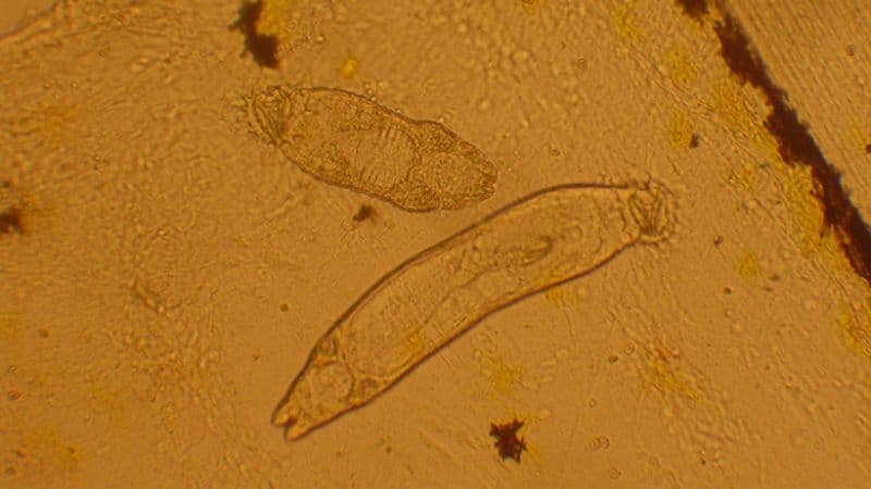 Mức độ nguy hiểm của sán lá gan nhỏ