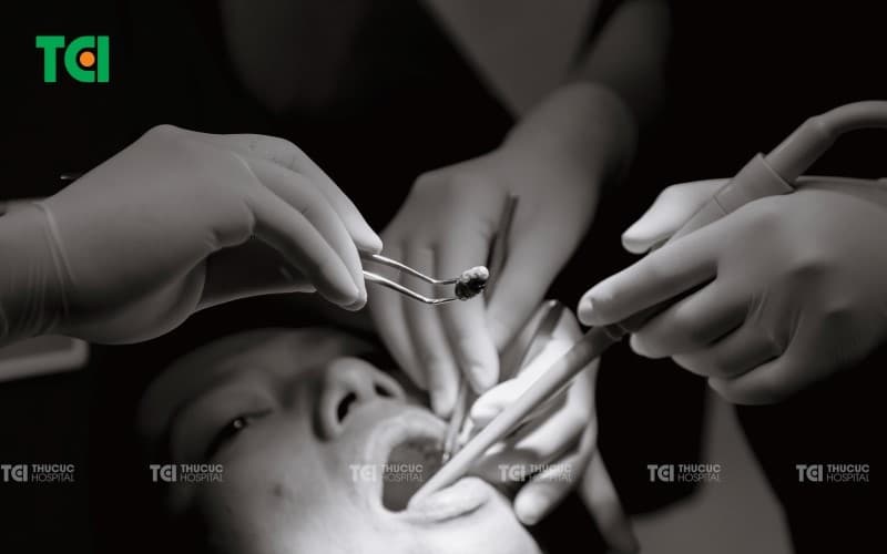 Viêm tuyến nước bọt