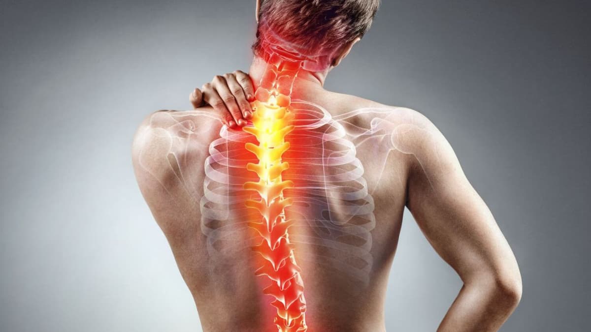 Triệu chứng thoái hóa đốt sống lưng chèn dây thần kinh