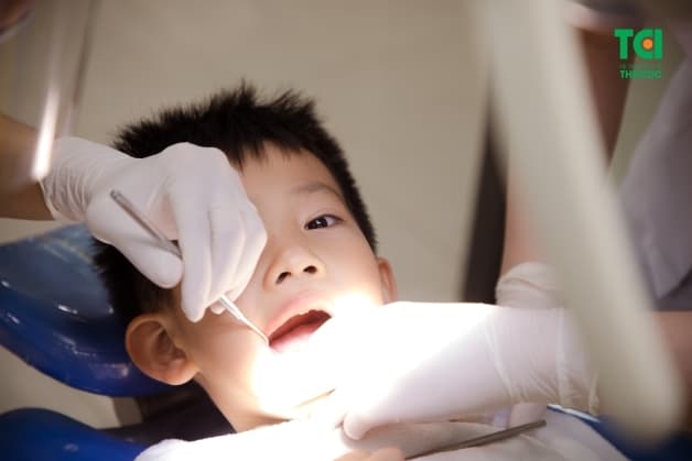 thời gian niềng răng trẻ em