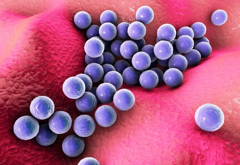 Vi khuẩn gây viêm bờ mi phổ biến nhất là Staphylococcus.