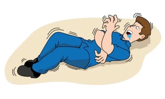 Các tác nhân kích hoạt cơn động kinh ở người bệnh