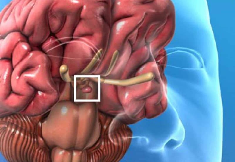 U tuyến yên hình thành do đâu?