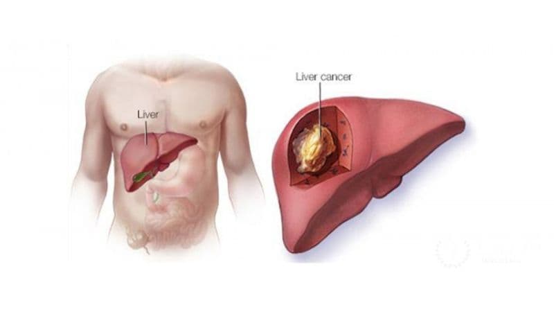 đặc điểm của sán lá gan