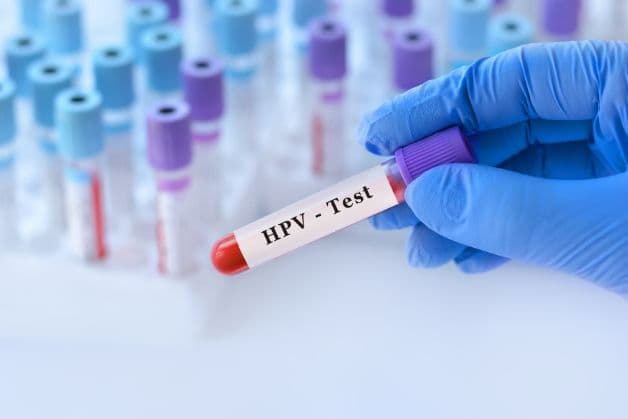 Nếu kết quả xét nghiệm HPV dương tính, bác sĩ sẽ đưa ra đánh giá và chỉ định phương pháp điều trị phù hợp, có thể bao gồm theo dõi, can thiệp hoặc phẫu thuật.