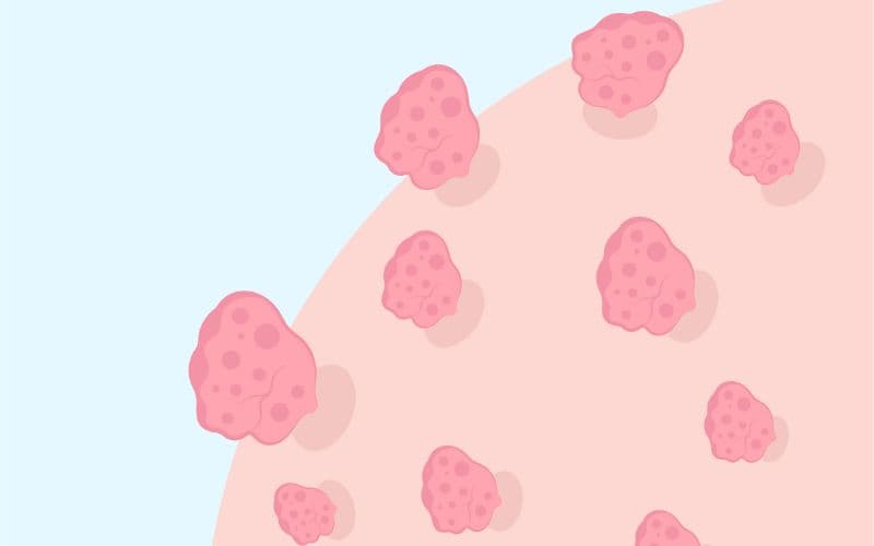 Bệnh đường tình dục gây ảnh hưởng nghiêm trọng đến sức khỏe cá nhân và cộng đồng